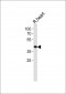 TOMM40L Antibody (N-term)